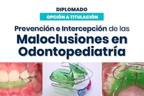 Prevención e Intercepción de las Maloclusiones en Odontopediatría